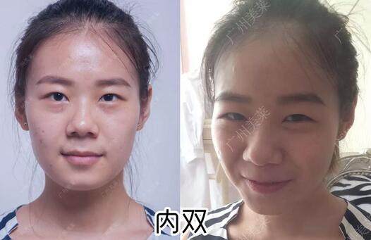 房祖名非成龙亲生？真相居然在成龙割了40年的双眼皮里？！