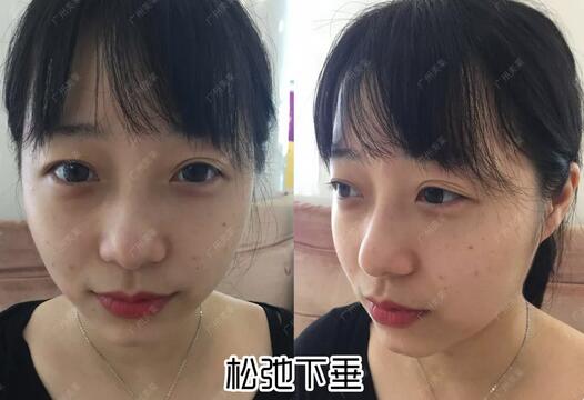 房祖名非成龙亲生？真相居然在成龙割了40年的双眼皮里？！