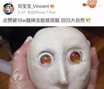 网红刘宝宝融掉脸上填充的50支玻尿酸后变这样！ width=