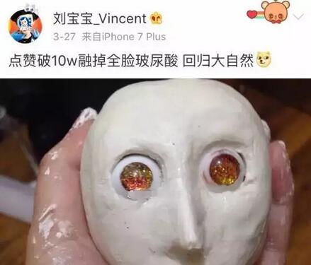网红刘宝宝融掉脸上填充的50支玻尿酸后变这样！