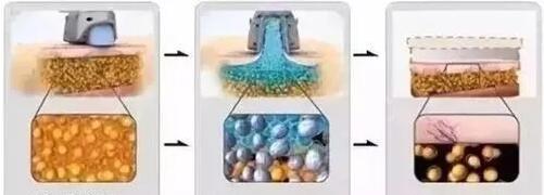 过完春节胖三斤？做这些医美项目让你躺着就能瘦