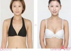 因隆胸而变自信的上海美女 width=
