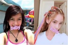 【真人案例】angelababy力证未整容，你羡慕她的“天然鼻”吗？ width=