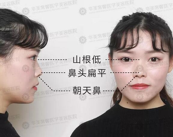 【年轻时越美，老了反而比同龄人更丑？！】