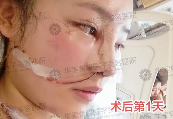 【年轻时越美，老了反而比同龄人更丑？！】