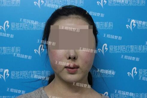 【能取出吗？取出是怎样的果呢~】