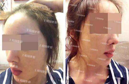 【能取出吗？取出是怎样的果呢~】