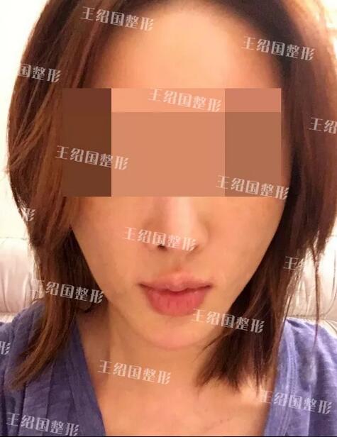 【能取出吗？取出是怎样的果呢~】