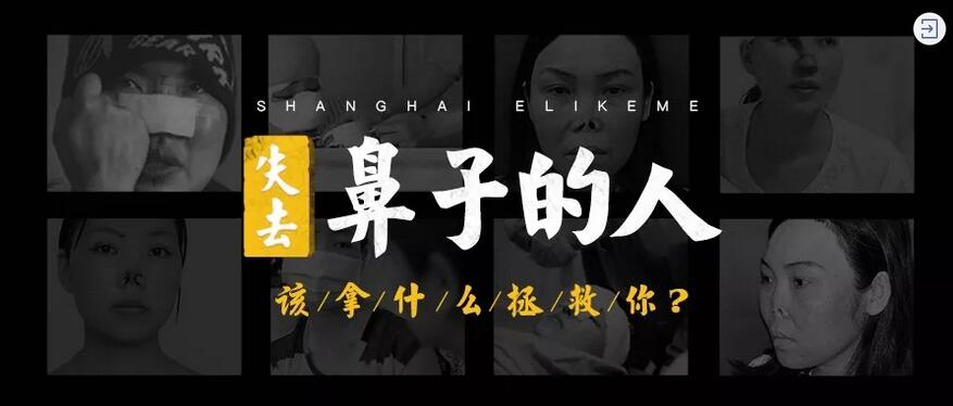 【失鼻重生，以爱铸容——上海伊莱美失鼻公益互助金计划招募启动】
