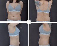AS维密体雕是什么鬼？张胜利院长写封信告诉你！ width=