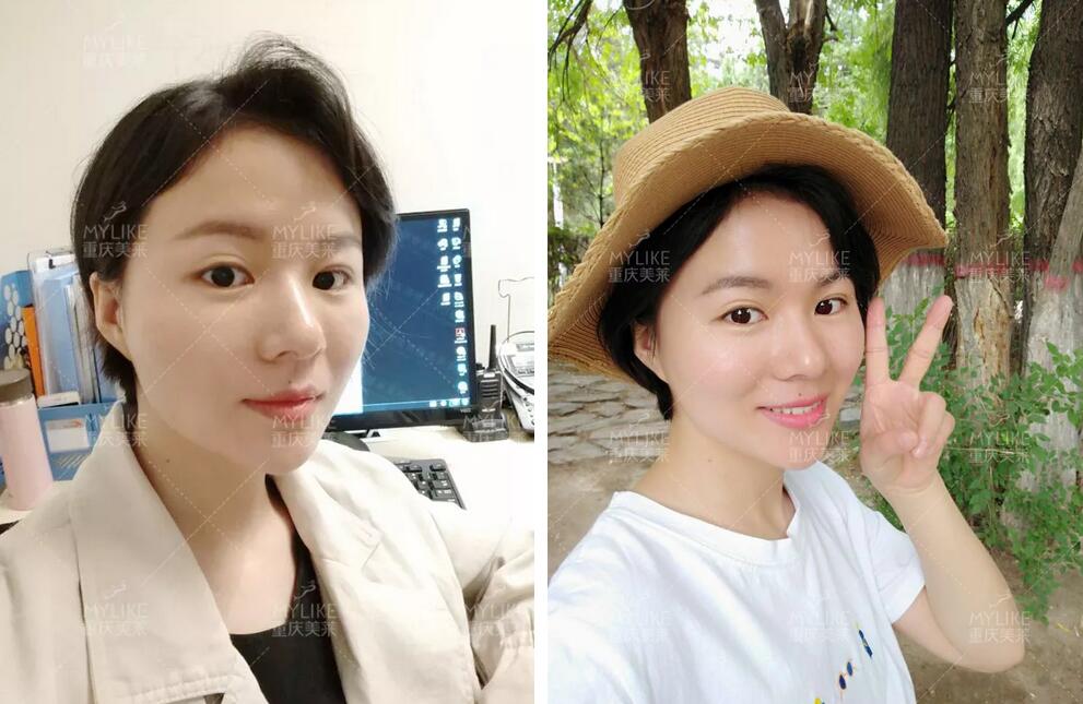 从痴迷自拍到卸掉所有自拍软件，她到底经历了神马？