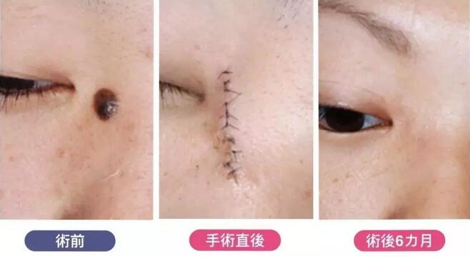 【酒井伦明：人好，技术好，性价比超高的双眼皮能手就是他啦！】
