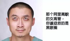 有很重的黑眼圈怎么办？如何消除呢？不急，一个一个回答你！ width=