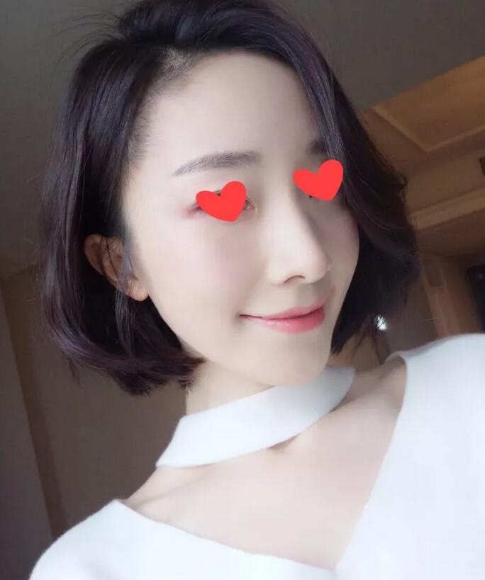 【热玛吉紧肤除皱是怎样一种体验？90后的她来聊聊一些亲身感受！】