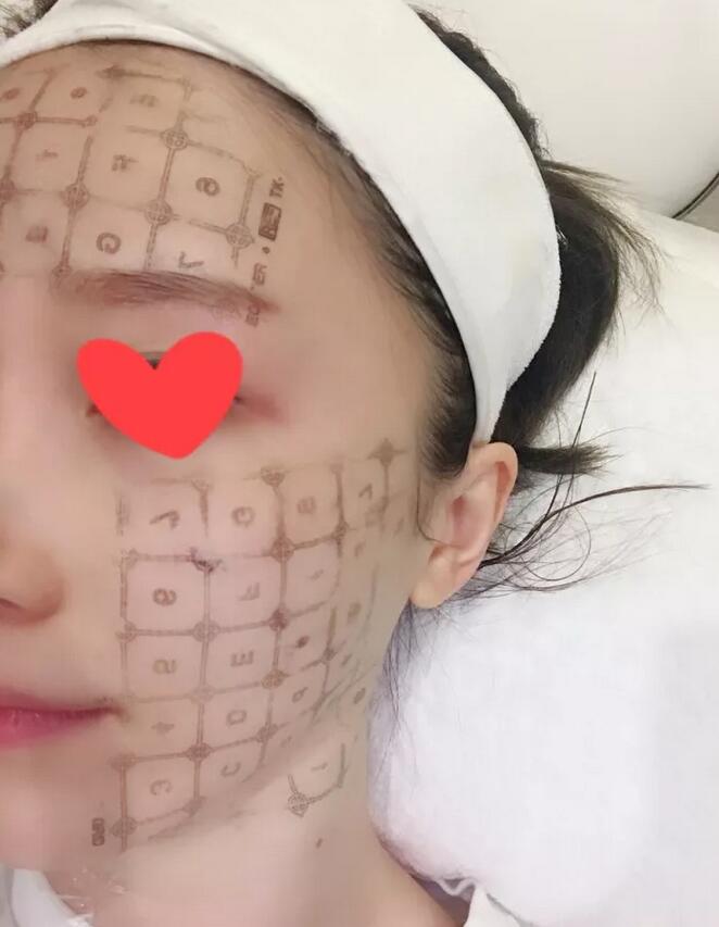 【热玛吉紧肤除皱是怎样一种体验？90后的她来聊聊一些亲身感受！】