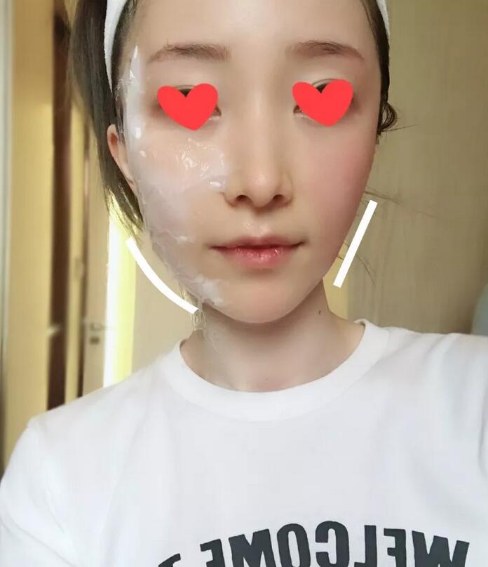 【热玛吉紧肤除皱是怎样一种体验？90后的她来聊聊一些亲身感受！】