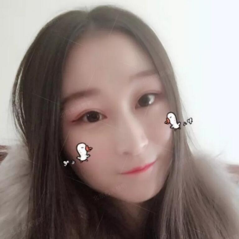 【芭比平行双眼皮的日记有没有发出来看下？我表妹想在今年做！】