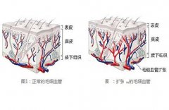 红血丝一直好不了你知道原因嘛? width=