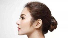 自软骨隆鼻后反被吸收，花了钱鼻子却打回了原型 width=