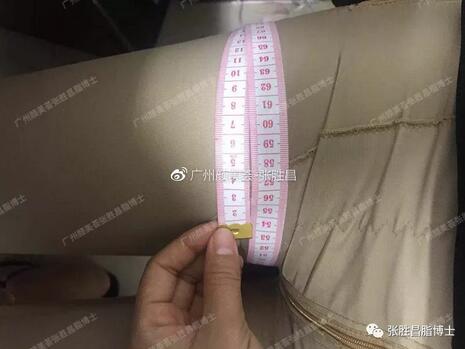 【大腿环吸案例】“从59cm到52cm，果较为满意，还想找你抽背”