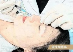 注射玻尿酸竟然过敏了，应该怎么办？ width=