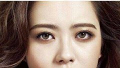 欧式全切双眼皮总共是什么价格?哪些因素能决定价格? width=