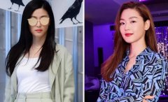 做完埋线提升1年后，脸会不会比以前更跨？ width=