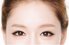 玻尿酸丰额头，让你青春永驻。 width=