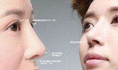 2019春季自体脂肪隆鼻果怎么样? width=