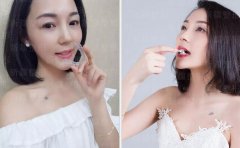 牙齿矫正的过程到底有多痛！小表妹用亲身经历告诉你！ width=