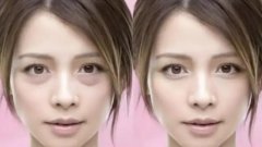 拒绝显龄金鱼眼，如何改良眼袋？ width=
