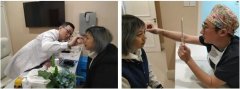 百万粉丝网红“宇宙”，眼鼻术后恢复历程大揭秘！‍ width=