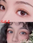 ＂肿眼泡＂土到爆！不服输的女人们都是怎么解决这个问题的？ width=