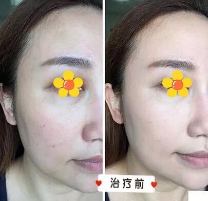 【伊美尔三维提塑术是个什么鬼？我找了个日记来给你看看果！】