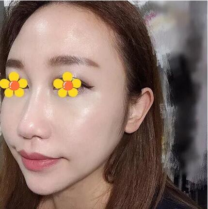 【伊美尔三维提塑术是个什么鬼？我找了个日记来给你看看果！】