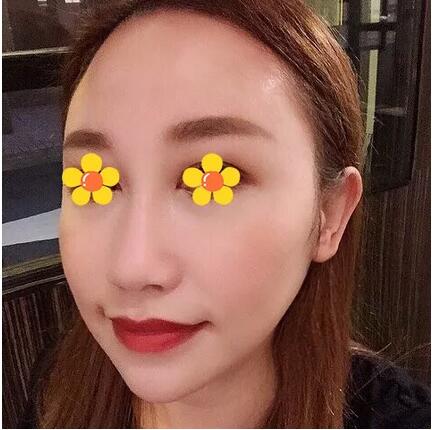 【伊美尔三维提塑术是个什么鬼？我找了个日记来给你看看果！】