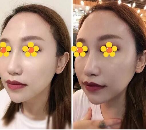 【伊美尔三维提塑术是个什么鬼？我找了个日记来给你看看果！】
