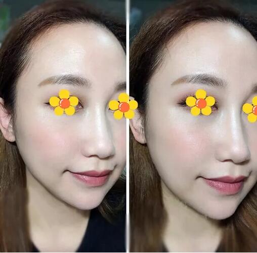 【伊美尔三维提塑术是个什么鬼？我找了个日记来给你看看果！】