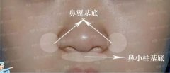 垫鼻基底有多重要？这类问题还要我亲自来回答你？？？ width=