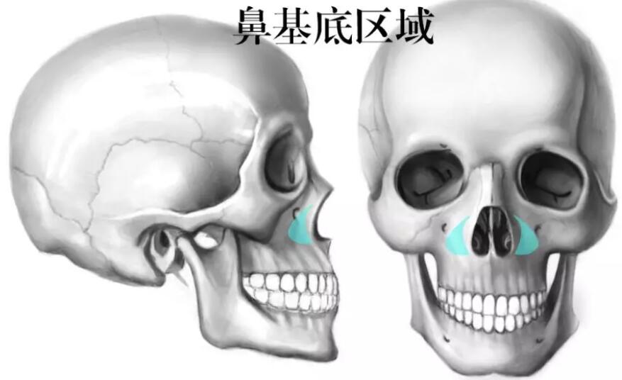 【垫鼻基底有多重要？这类问题还要我亲自来回答你？？？】