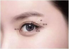 北京整形美容中心告诉你：欧式平行双眼皮是怎么做的? width=