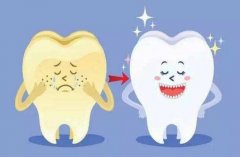 洗牙后牙缝变大是真的吗？有危害吗？一分钟内我想看到答案！ width=