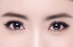 女儿，爸爸刚拉了双眼皮，你晚上回来看看！ width=