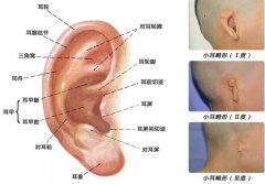 耳朵外廓畸形咋个整？这项非手术解决畸形的方法帮助您！ width=