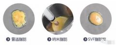 脂肪胶(SVF-gel)科普篇来啦，记下来，不要说我没有讲过！ width=