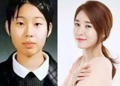 从女星们的整形经历上，我们可以学到什么？ width=