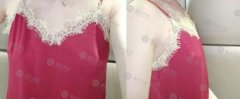 44岁身材傲人完爆20岁少女？！隆胸了解一下！ width=