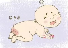 科普丨婴幼儿常见皮肤问题及如何应对 width=
