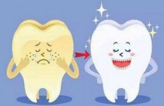较适合做牙齿矫正的三个时期 错过就会变麻烦 width=
