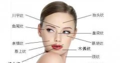 面部提升除皱让你重回年轻态 width=